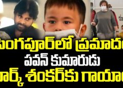 Pawan Kalyan's Son Mark Shankar Injured |