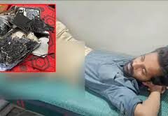Smartphone Explodes in Man's Pocket in Rangareddy, Causes Burn Injuries