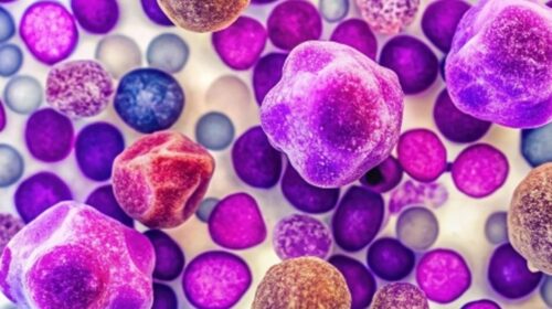 Melioidosis: Growing Concern in Guntur