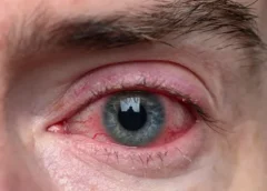 Can an Eye Exam Detect Heart Problems?